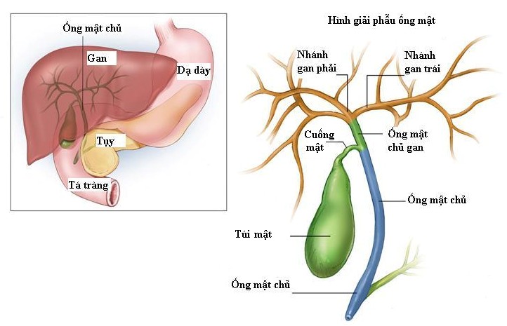 ung thư túi mật